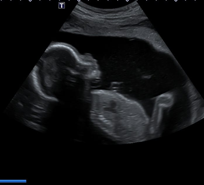 Ultrasound equipment