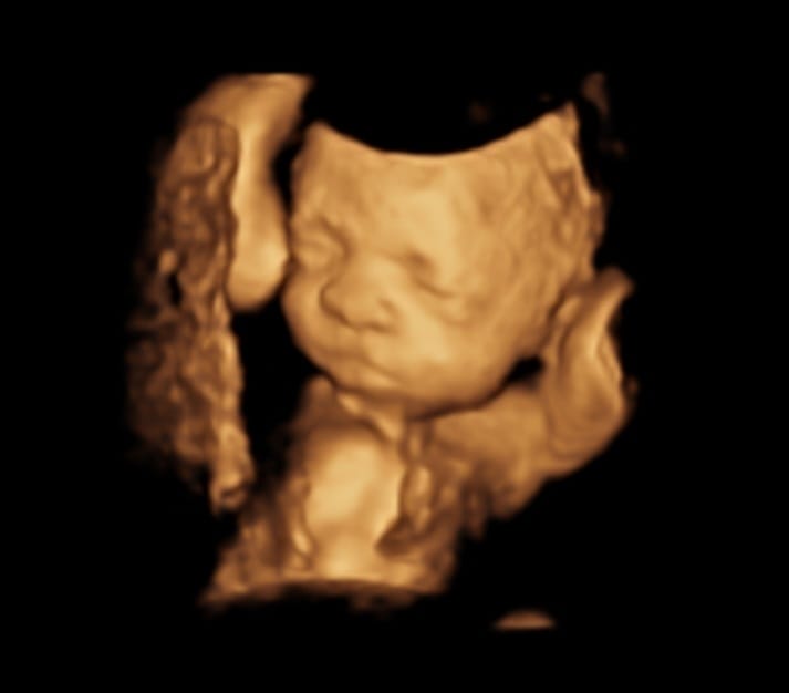 Ultrasound equipment
