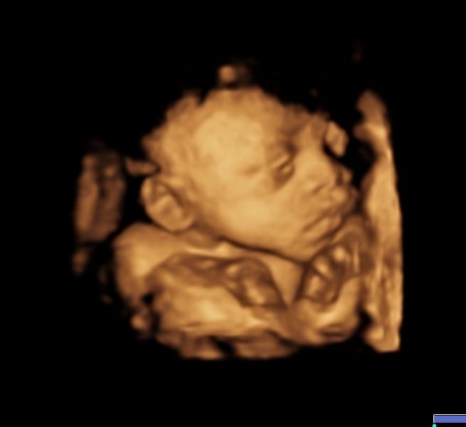 Ultrasound equipment