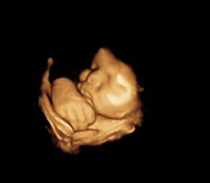 Ultrasound equipment