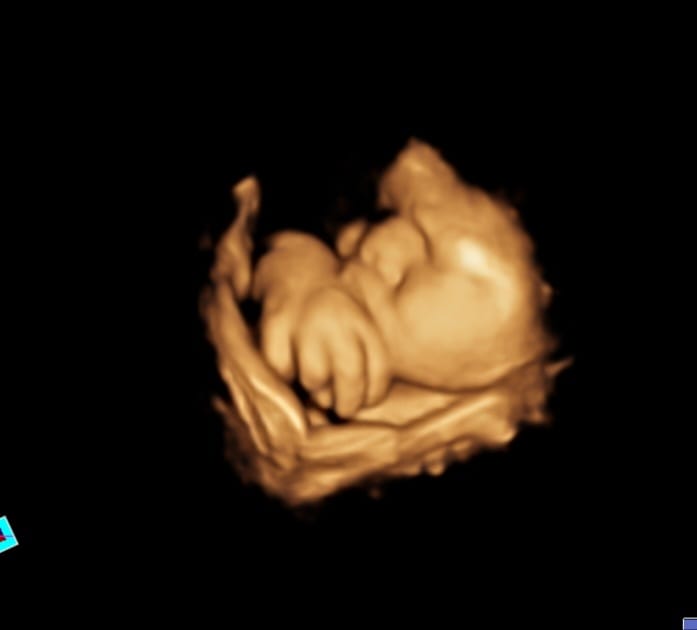 Ultrasound equipment