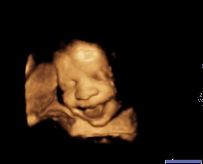 Ultrasound equipment