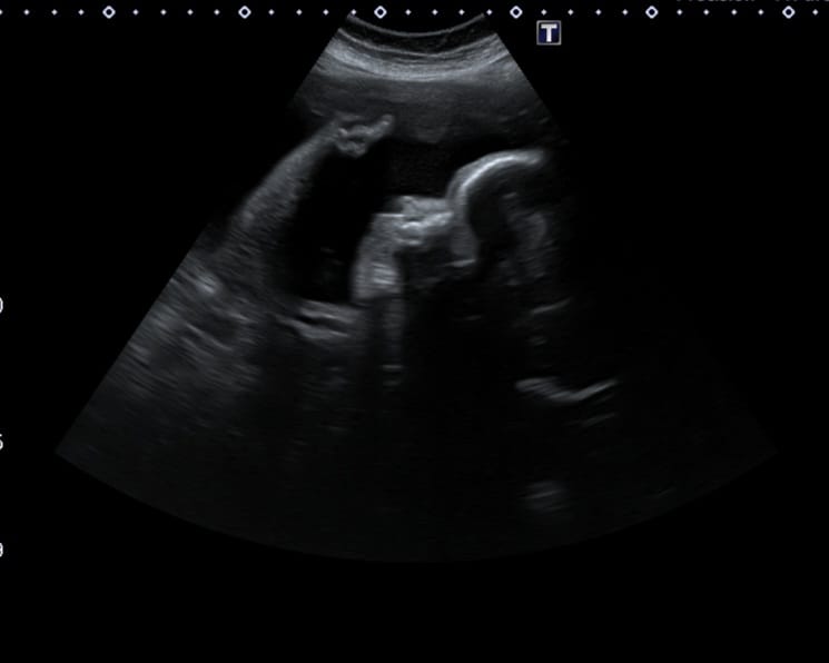 Ultrasound equipment